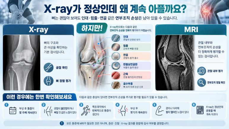 유도 등 운동 중 부상, X-ray는 정상인데 계속 아프다면? ｜ 스포츠 손상 MRI 검사 안내